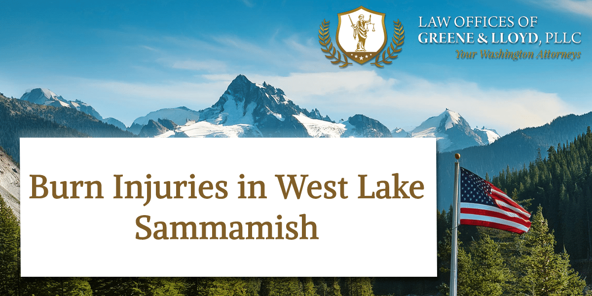 Burn Injuries in West Lake Sammamish Washington - New